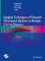 [PDF]Surgical Techniques of Focused Ultrasound Ablation in Benign Uterine Diseases