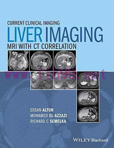 [FOX-Ebook]Liver Imaging: MRI with CT Correlation