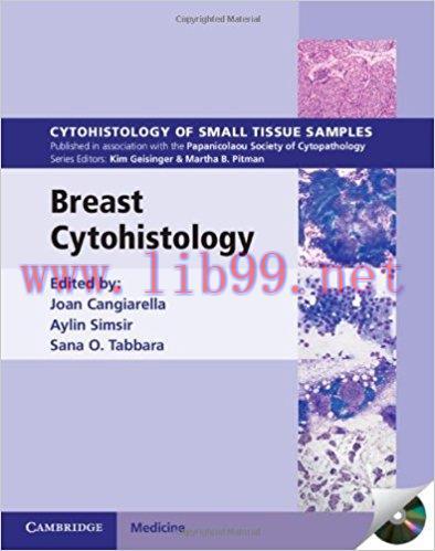 [PDF]Breast Cytohistology(Cytohistology of Small Tissue Samples)