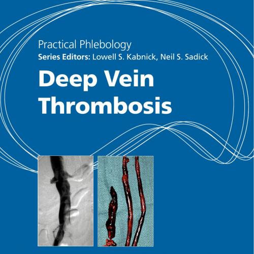 Practical Phlebology Deep Vein Thrombosis