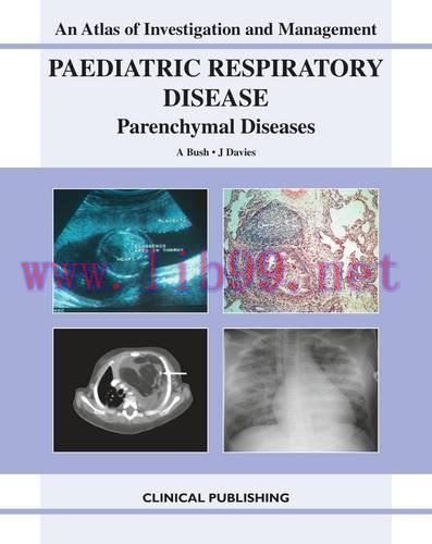 [AME]Paediatric Respiratory Disease, Parenchymal Diseases: An Atlas of Investigation and Manage...