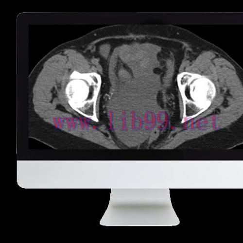 [AME]Radiologic Reasoning: A Rapid-Fire Multispecialty Review 2018 (ARRS VIDEOS) (CME VIDEOS)