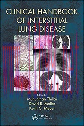 [PDF]Clinical Handbook of Interstitial Lung Disease