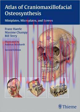 [AME]Atlas of Craniomaxillofacial Osteosynthesis: Microplates, Miniplates, and Screws, 2nd Edit...