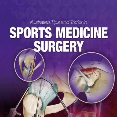 Illustrated Tips and Tricks in Sports Medicine Surgery - Frederick Azar