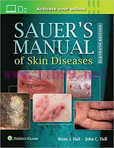[EPUB]Sauer&rsquo;s Manual of Skin Diseases 11th Edition