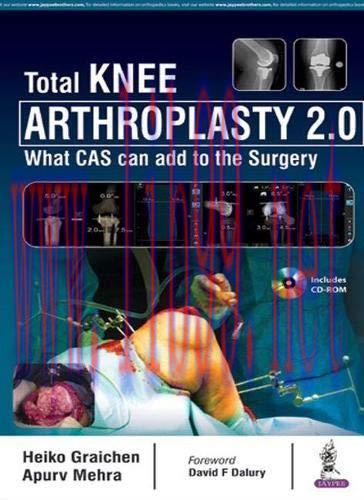 [AME]Total Knee Arthroplasty 2.0: What CAS can add to the Surgery (Original PDF)