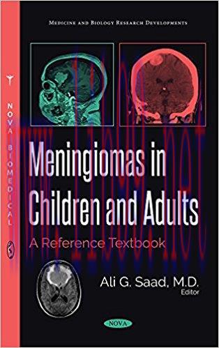 [AME]Meningiomas in Children and Adults: A Reference Textbook (Original PDF)
