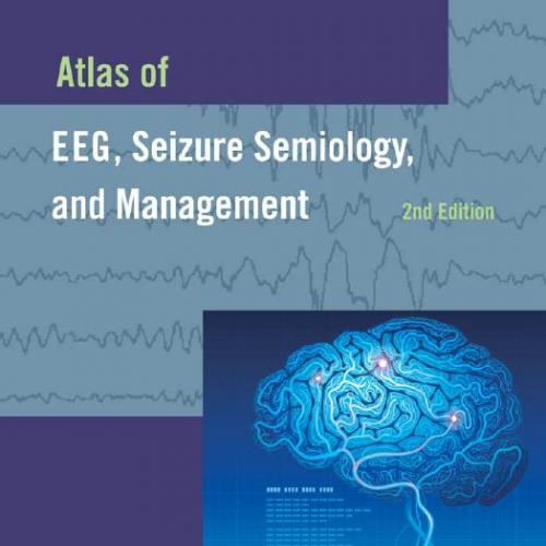 Atlas of EEG, Seizure Semiology, and Management - Karl E. Misulis