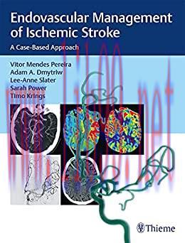 [AME]Endovascular Management of Ischemic Stroke: A Case-Based Approach (EPUB)