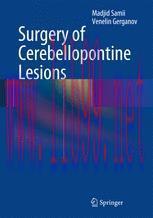 [PDF]Surgery of Cerebellopontine Lesions
