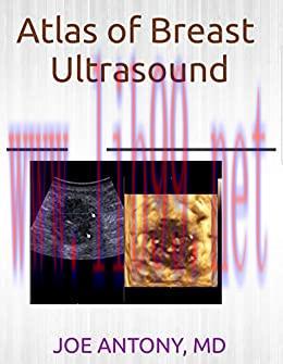 [AME]Atlas of breast ultrasound (Original PDF)