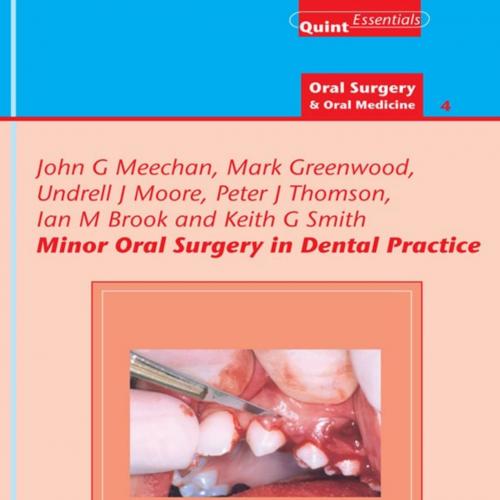 Minor Oral Surgery in Dental Practice