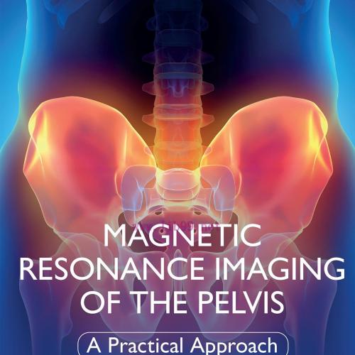 [AME]Magnetic Resonance Imaging of The Pelvis: A Practical Approach (EPUB)