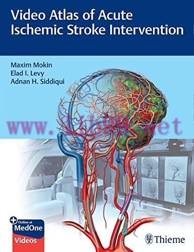 [AME]Video Atlas of Acute Ischemic Stroke Intervention (Original PDF+Videos)