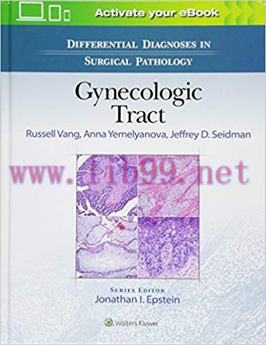 [CHM]Differential Diagnoses in Surgical Pathology - Gynecologic Tract