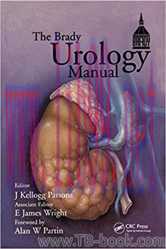 Brady Urology Manual 1st Edition by J. Kellogg Parsons