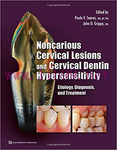 [PDF]Noncarious Cervical Lesions and Cervical Dentin Hypersensitivity: Etiology, Diagnosis, and...