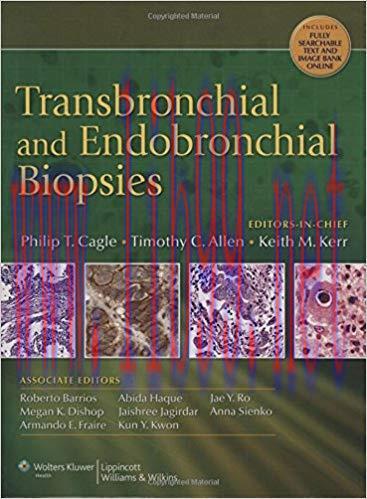 [PDF]Transbronchial and Endobronchial Biopsies
