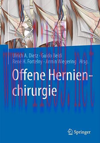 [AME]Offene Hernienchirurgie (German Edition) (Original PDF)