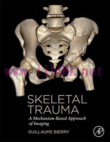 [AME]Skeletal Trauma: A Mechanism-Based Approach of Imaging (Original PDF)