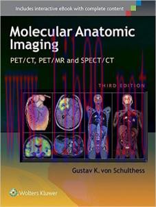 [AME]Molecular Anatomic Imaging: PET/CT, PET/MR and SPECT CT, Third Edition (EPUB)