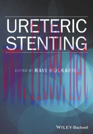 [AME]Ureteric Stenting (PDF)