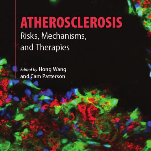 Atherosclerosis Risks, Mechanisms, and Therapies