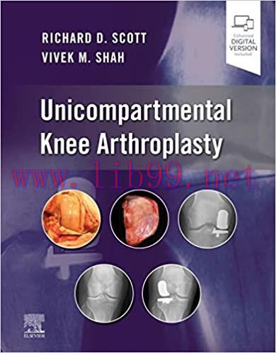[PDF]Unicompartmental Knee Arthroplasty, E-Book