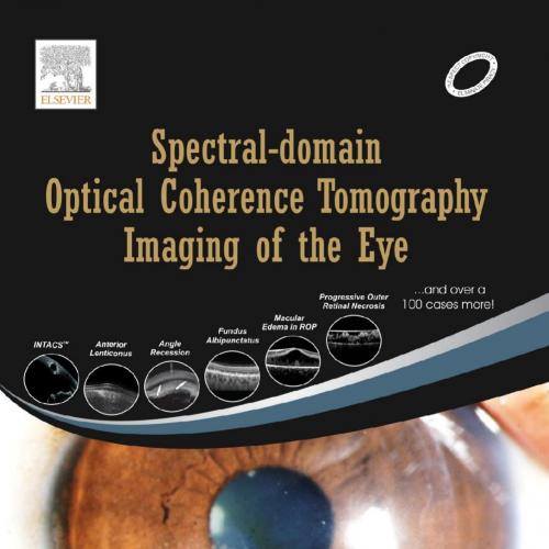 Spectral Domain OCT-Wei Zhi