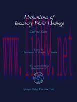[PDF]Mechanisms of Secondary Brain Damage: Current State