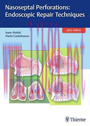 [AME]Nasoseptal Perforations: Endoscopic Repair Techniques (EPUB)