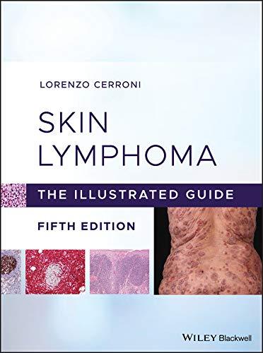 Skin Lymphoma The Illustrated Guide, Fifth Edition