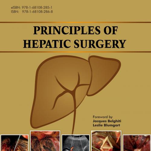 Principles of Hepatic Surgery