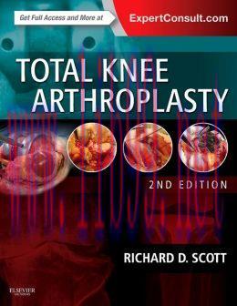 [AME]Total Knee Arthroplasty, 2nd Edition (ORIGINAL PDF from_ Publisher)