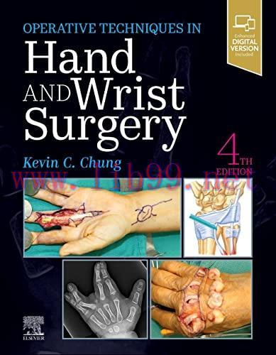 [AME]Operative Techniques: Hand and Wrist Surgery, 4th Edition (Original PDF)