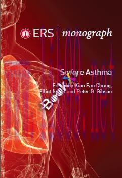 [PDF]Severe Asthma (ERS Monograph 84)