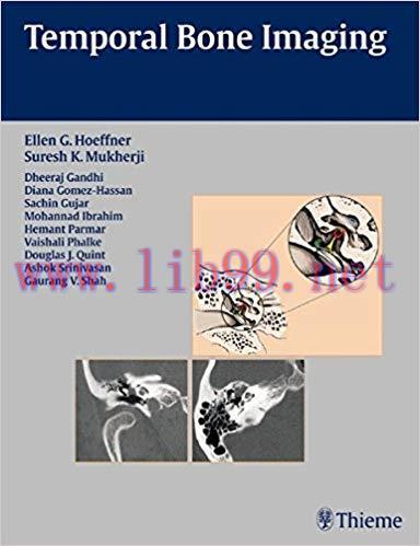 [PDF]Temporal Bone Imaging [Ellen G. Hoeffner]
