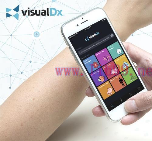 [AME]VisualDx (1-year Subscription)