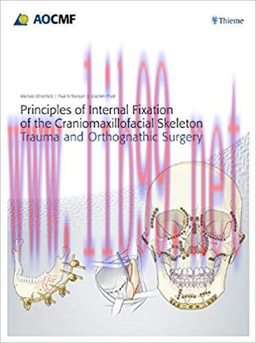 [PDF]Principles of Internal Fixation of the Craniomaxillofacial Skeleton