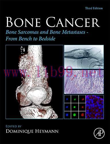 [AME]Bone Cancer: Bone Sarcomas and Bone Metastases &ndash; From_ Bench to Bedside, 3rd Edition (Orig...
