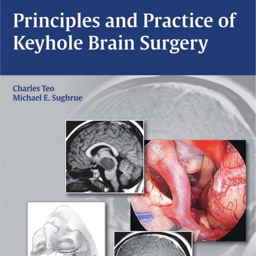 Principles and Practice of Keyhole Brain Surgery
