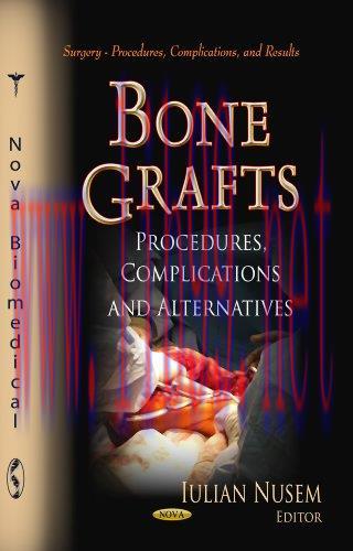 [AME]Bone Grafts: Procedures, Complications and Alternatives (Surgery &ndash; Procedures, Complicatio...