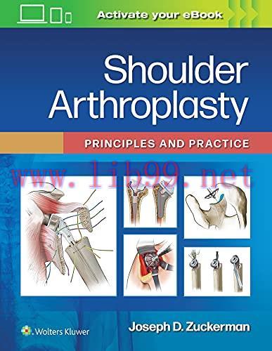 [AME]Shoulder Arthroplasty: Principles and Practice (ePub3+Converted PDF)