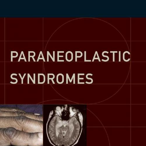 Paraneoplastic Syndromes - Darnell, Robert.,Posner, Jerome B_