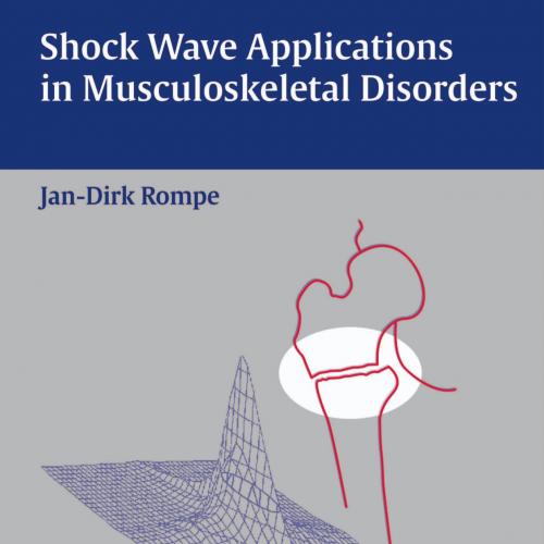 Shock Wave Applications in Musculoskeletal Disorders