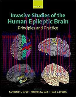 (PDF)Invasive Studies of the Human Epileptic Brain: Principles and Practice 1st Edition