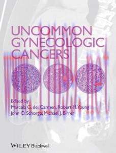 [AME]Uncommon Gynecologic Cancers