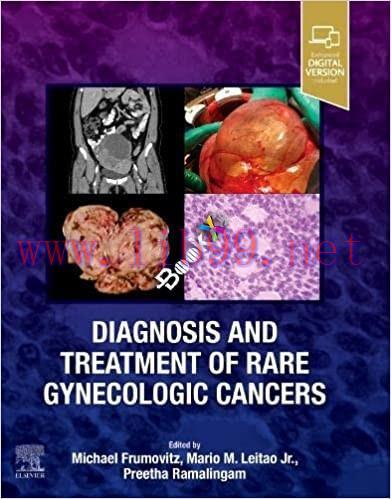 [PDF]Diagnosis and Treatment of Rare Gynecologic Cancers