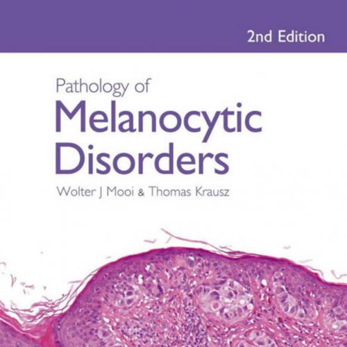 Pathology of Melanocytic Disorders 2nd Edition